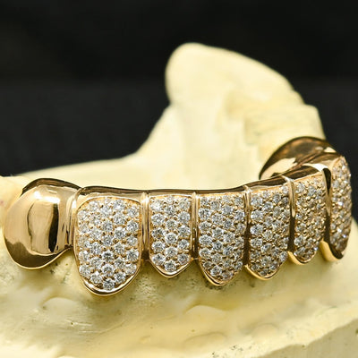 GRILLZ ARGENT 925 Moissanite VVS1